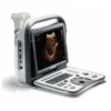 affordable ultrasound machine kenya